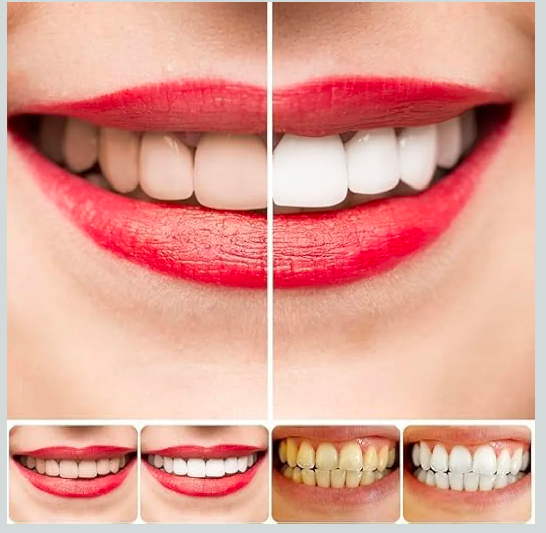 Sp-4 probiotic whitening toothpaste, Teeth Whitener Toothpaste, Natural Tooth Whitener (PACK OF 2)